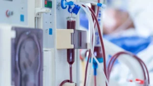 Lesão Renal Aguda que precisa de diálise: o que acontece depois da alta hospitalar?