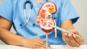 Semaglutida (Ozempic) e os rins: uma nova era no tratamento da doença renal diabética?